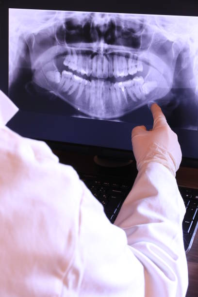 Best Emergency Dentist for Lost Fillings or Crowns in Wayne, IL